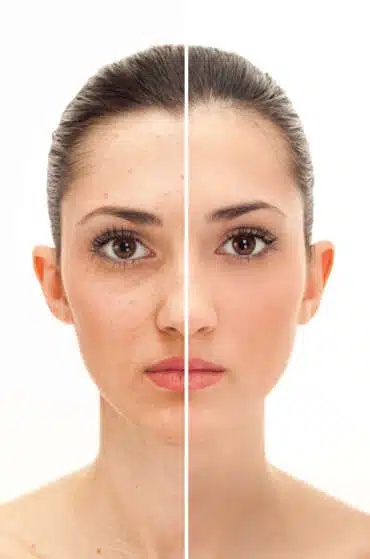 Before and after example of natural portrait retouching